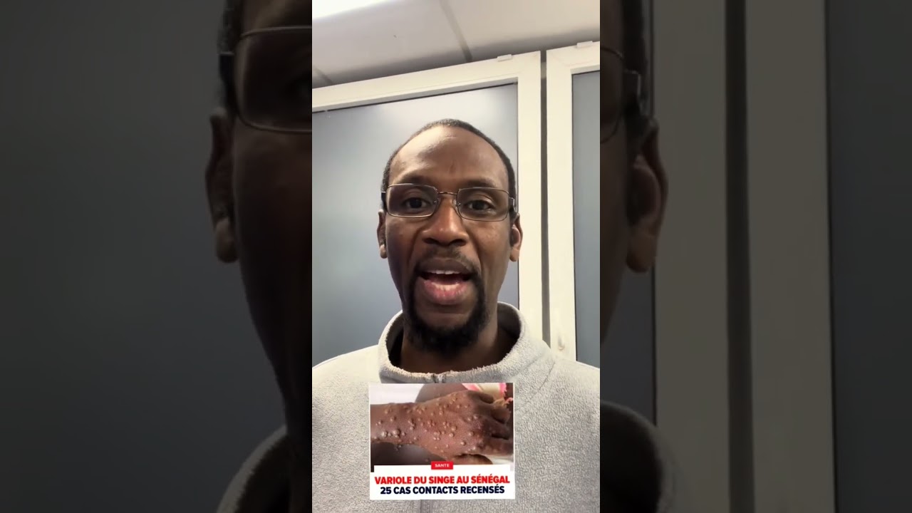 #Prévention #MPOX, une maladie très contagieuse