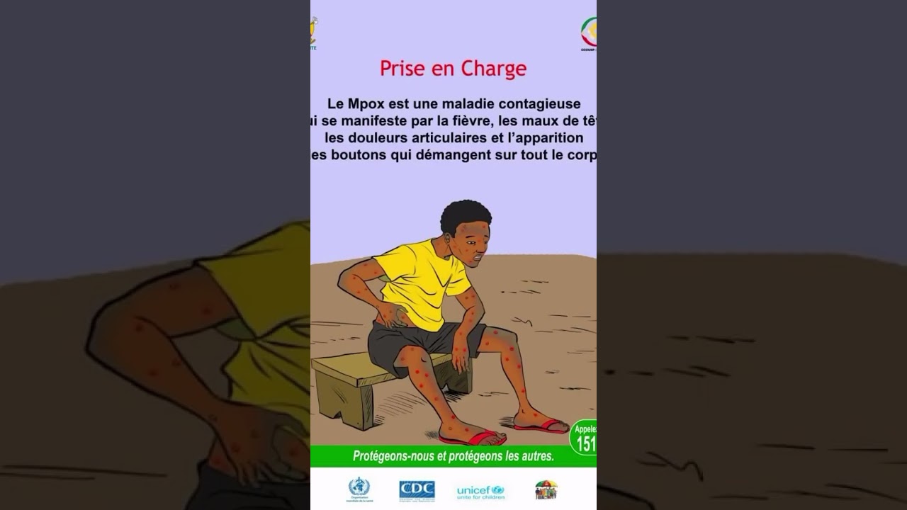 Prévention MPOX qui est une maladie très contagieuse